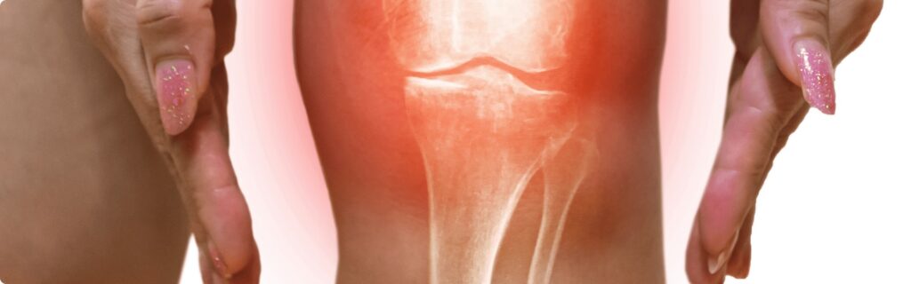 Personne âgée pratiquant une activité physique douce pour soulager l'arthrose